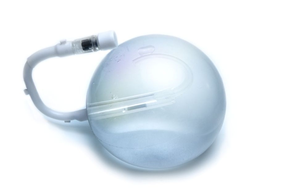 Magenballon für 6 Monate